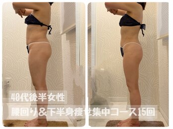 ピーエフ トウキョウ(PF TOKYO)/ハイパーナイフEX下半身集中