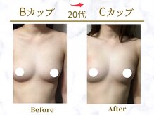 Ms.やまとなでしこ/【ビフォーアフター】B→Cカップ