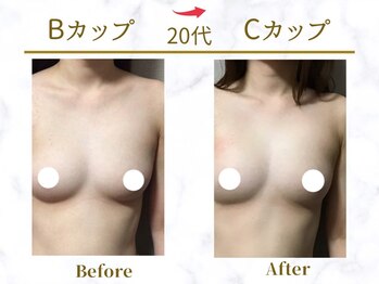 Ms.やまとなでしこ/【ビフォーアフター】B→Cカップ