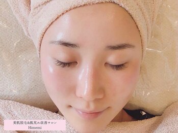ヒメミ(Himemi)の写真/くすみが取れて、ワントーン明るい透明肌へ！美容液がグングン浸透◎吸い付くような「もち肌美人」に。