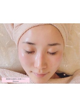 顔脱毛がしたい