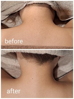 アースコアフュールボーテ ひたち野うしく店(EARTH coiffure beaute)/うなじ脱毛で清潔感UP♪
