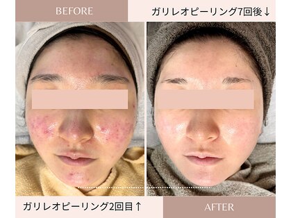 ルームエイトエイティスリー 新宿(R883)の写真