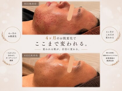 アンリミット 代々木上原店(Une limit)の写真