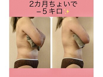 ズーサロン(zu_salon)の写真/都度払いor3回コースのどちらかのみです。