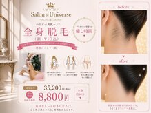 サロンド ユニバース(salon de universe)の雰囲気（2種類の方式を利用したオーダーメイド脱毛は効果が早い☆）
