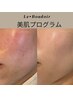 美肌3ヶ月プログラム無料カウンセリング