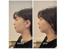 蒼月(aotsuki)/Before/After 