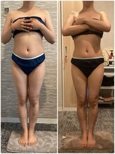 ハレアンド(Hare&)/30代ブライダルBefore After