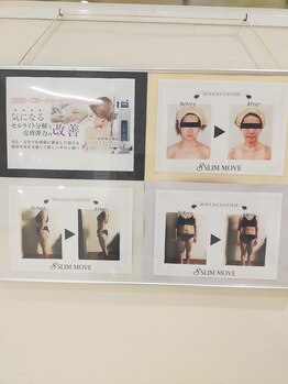 チェルシー 小岩店(Chelsea)/スリムムーブ