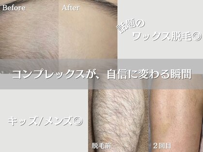 美肌脱毛専門店 パールプラス 大在店の写真