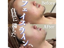 ラフィール/フェイスラインに自信！！