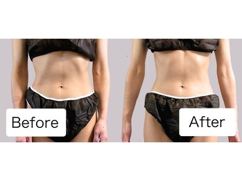 リュシータ 吹田千里丘店(LUSHEETA)/【 VENUS痩身 】(40代前半)