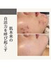 《武内限定》ハーブピーリング剥離あり+ヘッドスパ＆首・肩マッサージ