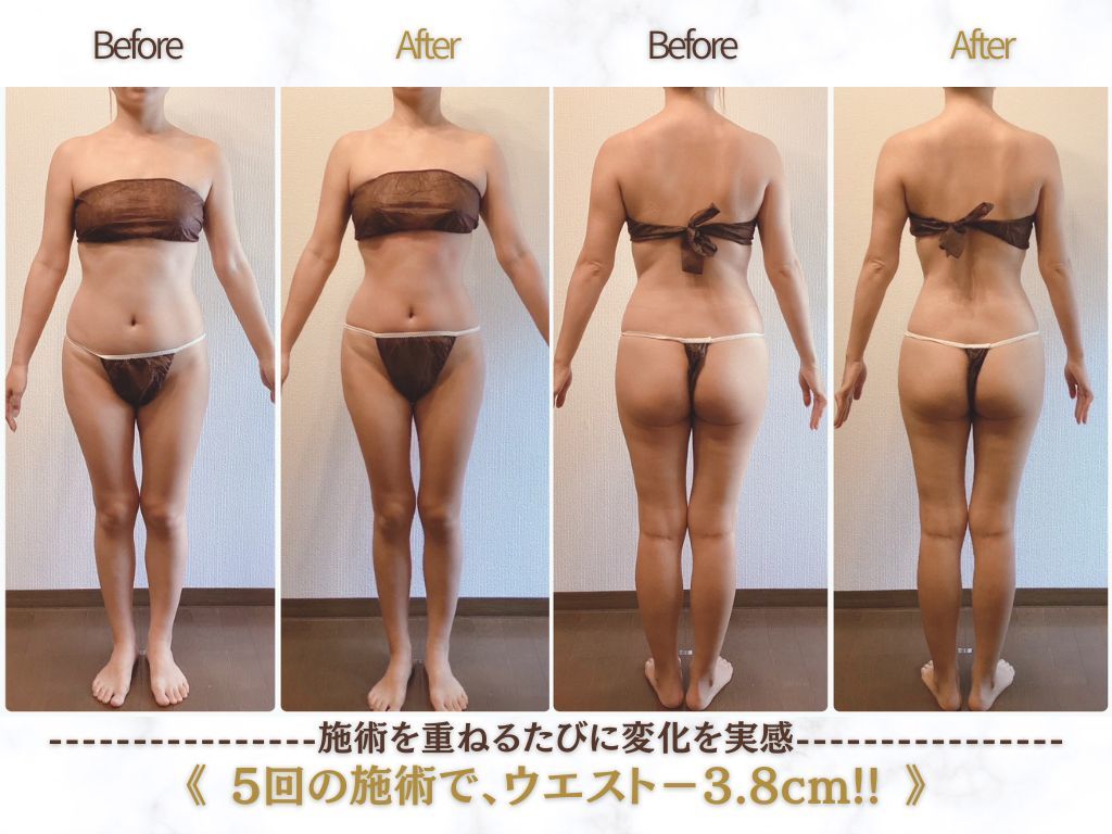 春日井市でエンダモロジーが人気のエステサロン｜ホットペッパー