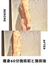 レオナルド(Leonardo)/痩身60分体験後