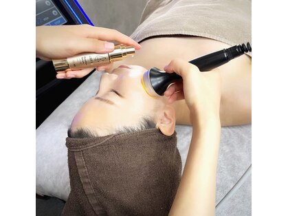 アルビ(ARuBi)の写真