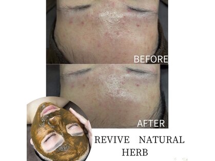 メルシー(merci)の写真