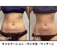 アイリーボーテ 東大阪(アイリーBEAUTE)