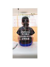 おざき整体院/姿勢改善/猫背/肩こり