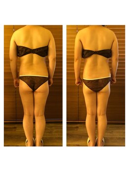 ラナ(LANA)/【痩身】スリムボディ