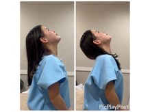 ヴィーライン 恵比寿本院(VeLine)/ボディ施術のBefore After