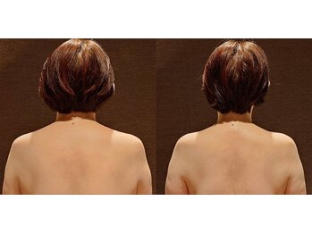 ロゼッタビューティー(Rosetta Beauty)/年代別オイル整体☆50代の方向け