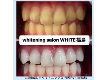ホワイトニングサロン ホワイト(WHITE)/セルフホワイトニング/大阪/福島