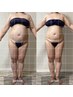 【１番人気！諦めてたぜい肉撃退】爆痩セルゼロ痩身