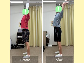 ナオル整体 大宮院(NAORU整体)/肩の動きが良くなる！