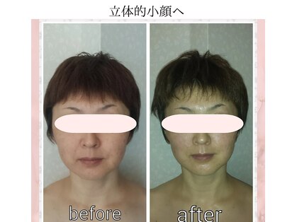 プライベートサロン 美月の写真