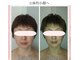 プライベートサロン 美月の写真