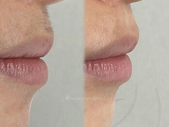 ワクシー 麻布十番店(WAXYYY.)/フェイスワックス
