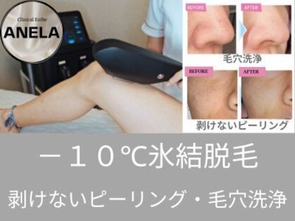 アネラ(ANELA)の写真