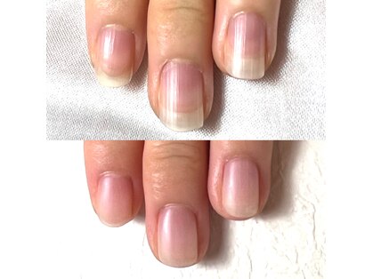 ネイルプルーフ(NAIL proof)の写真
