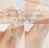 アネラ(ANELA)