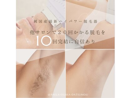 アネラ(ANELA)の写真