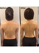 エニ 恵比寿(eni)/背中のビフォーアフター