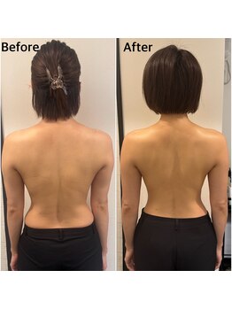 エニ 恵比寿(eni)/背中のビフォーアフター