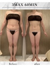 ラズリ(Lazuli)/3max60分20回