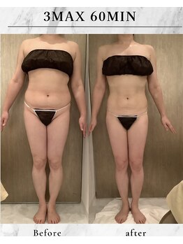 ラズリ(Lazuli)/3max60分20回