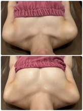 ロココ 豊田店(Rococo)/ビフォーアフター