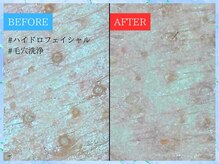 ティアワン 麻布十番(Tierone)の雰囲気（【ハイドロ/1回】肌負担の少ない毛穴洗浄でうるつや肌をGET！）