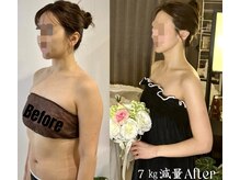 ソウ バイ ソウ(So by 蒼)/他店と比較する際は最後に当店へ