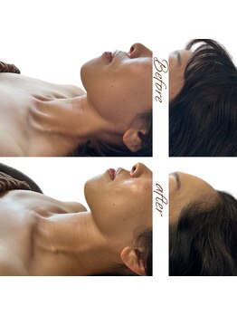 マヌレニ(manuleni)/老け見えのひとつは首のスジ