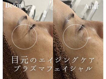 ミセル(MISEL2nd)/目元のエイジングケアにも★