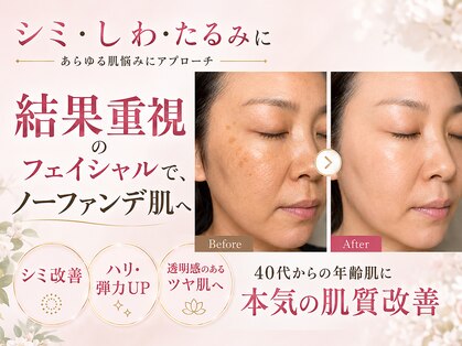 キャンドル(candle')の写真