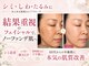 キャンドル(candle')の写真