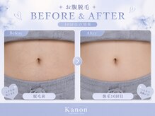 カノン 南熊本店(Kanon)/