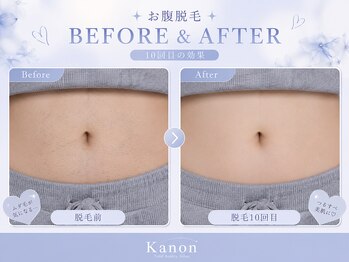 カノン 南熊本店(Kanon)/